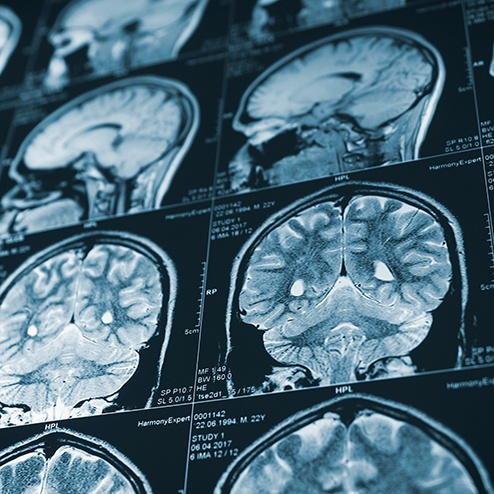 a close-up of CT scan images