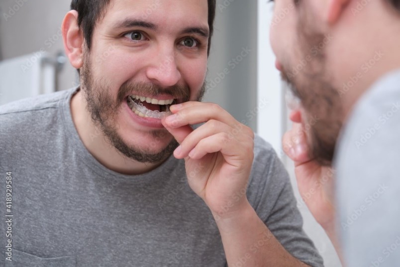 Man placing his oral appliance before going to bed.